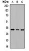 Adenosine A2b Receptor antibody, GTX54903, GeneTex, Western Blot image 