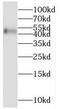 Melanin Concentrating Hormone Receptor 1 antibody, FNab05051, FineTest, Western Blot image 