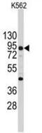 Cadherin 3 antibody, PA5-11587, Invitrogen Antibodies, Western Blot image 