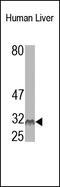 Chloride Intracellular Channel 2 antibody, 251936, Abbiotec, Western Blot image 