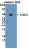 Adhesion G Protein-Coupled Receptor L3 antibody, LS-C372506, Lifespan Biosciences, Western Blot image 