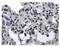 Integrin Subunit Alpha E antibody, GTX53154, GeneTex, Immunohistochemistry paraffin image 