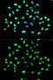 Heterogeneous Nuclear Ribonucleoprotein K antibody, GTX32658, GeneTex, Immunocytochemistry image 