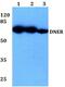 Delta/Notch Like EGF Repeat Containing antibody, PA5-37263, Invitrogen Antibodies, Western Blot image 