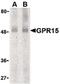 G Protein-Coupled Receptor 15 antibody, PA5-19912, Invitrogen Antibodies, Western Blot image 