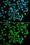 cAMP-dependent protein kinase catalytic subunit gamma antibody, STJ110026, St John