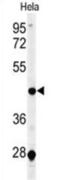 Chimerin 2 antibody, abx034393, Abbexa, Western Blot image 