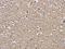 RAP1B, Member Of RAS Oncogene Family antibody, orb518580, Biorbyt, Immunohistochemistry paraffin image 