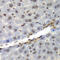 Negative Elongation Factor Complex Member E antibody, 19-008, ProSci, Immunohistochemistry paraffin image 