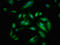 Signal-Induced Proliferation-Associated 1 antibody, LS-C671456, Lifespan Biosciences, Immunofluorescence image 