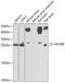 Myosin Light Chain 6B antibody, GTX66599, GeneTex, Western Blot image 