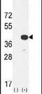 Cathepsin K antibody, PA5-14270, Invitrogen Antibodies, Western Blot image 