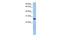 Eukaryotic Translation Initiation Factor 4H antibody, GTX47263, GeneTex, Western Blot image 