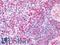 HS1 antibody, LS-B4340, Lifespan Biosciences, Immunohistochemistry paraffin image 