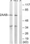 Protein Phosphatase 2 Scaffold Subunit Abeta antibody, LS-B6593, Lifespan Biosciences, Western Blot image 