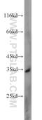 Uridine-Cytidine Kinase 2 antibody, 10511-1-AP, Proteintech Group, Western Blot image 