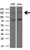 TSC Complex Subunit 1 antibody, M00365, Boster Biological Technology, Western Blot image 
