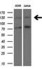 TSC Complex Subunit 1 antibody, M00365, Boster Biological Technology, Western Blot image 