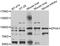 EPH Receptor A1 antibody, STJ29467, St John