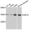 Aquaporin 10 antibody, STJ22659, St John