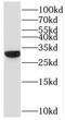 Voltage Dependent Anion Channel 3 antibody, FNab09388, FineTest, Western Blot image 