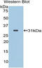 Prolylcarboxypeptidase antibody, LS-C296055, Lifespan Biosciences, Western Blot image 