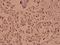 Checkpoint Kinase 1 antibody, A01060-2, Boster Biological Technology, Immunohistochemistry paraffin image 