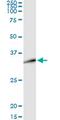 Distal-Less Homeobox 1 antibody, MA5-18735, Invitrogen Antibodies, Immunoprecipitation image 