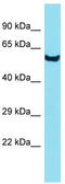 Dihydrouridine Synthase 3 Like antibody, TA335503, Origene, Western Blot image 