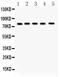 Follicle Stimulating Hormone Receptor antibody, PB10065, Boster Biological Technology, Western Blot image 