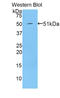 Thrombospondin 2 antibody, LS-C296620, Lifespan Biosciences, Western Blot image 