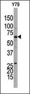 Guanylate Cyclase 1 Soluble Subunit Beta 1 antibody, PA5-15494, Invitrogen Antibodies, Western Blot image 