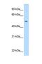 Neuraminidase 1 antibody, NBP1-69387, Novus Biologicals, Western Blot image 