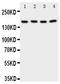 Phospholipase A2 Group IVA antibody, PA2047, Boster Biological Technology, Western Blot image 