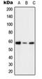 6-Phosphofructo-2-Kinase/Fructose-2,6-Biphosphatase 2 antibody, orb214383, Biorbyt, Western Blot image 