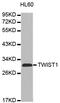 Twist Family BHLH Transcription Factor 1 antibody, LS-C334113, Lifespan Biosciences, Western Blot image 