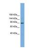 Tetratricopeptide Repeat Domain 27 antibody, NBP1-79659, Novus Biologicals, Western Blot image 
