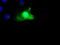 SCY1 Like Pseudokinase 3 antibody, M11167-1, Boster Biological Technology, Immunofluorescence image 