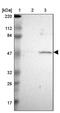 Cholinergic Receptor Nicotinic Beta 1 Subunit antibody, PA5-52213, Invitrogen Antibodies, Western Blot image 