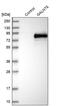 Polypeptide N-Acetylgalactosaminyltransferase 6 antibody, PA5-52852, Invitrogen Antibodies, Western Blot image 