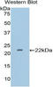 CD36 Molecule antibody, LS-C295967, Lifespan Biosciences, Western Blot image 