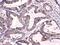 Cast antibody, PA5-78925, Invitrogen Antibodies, Immunohistochemistry paraffin image 