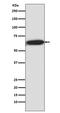 Ribosomal Protein S6 Kinase B1 antibody, P01475, Boster Biological Technology, Western Blot image 