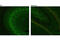 Huntingtin antibody, 5656S, Cell Signaling Technology, Immunofluorescence image 