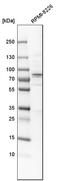 Acyl-CoA Synthetase Short Chain Family Member 2 antibody, HPA004141, Atlas Antibodies, Western Blot image 