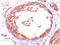 ERBB2 antibody, AM32822PU-T, Origene, Immunohistochemistry frozen image 