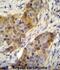 Ankyrin Repeat Domain 39 antibody, abx026125, Abbexa, Immunohistochemistry paraffin image 