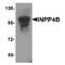 Inositol Polyphosphate-4-Phosphatase Type II B antibody, TA349199, Origene, Western Blot image 