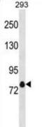 Potassium Voltage-Gated Channel Subfamily A Member 4 antibody, abx031324, Abbexa, Western Blot image 