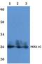 Peroxisomal Biogenesis Factor 11 Gamma antibody, A12566-1, Boster Biological Technology, Western Blot image 
